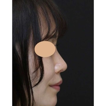 聖心美容クリニックの症例写真[アフター]