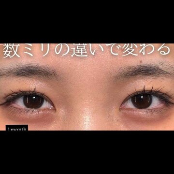 PRISM Beauty Clinicの症例写真[アフター]