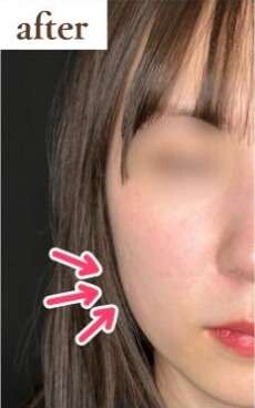 ルラ（LULA）美容クリニックの症例写真[アフター]