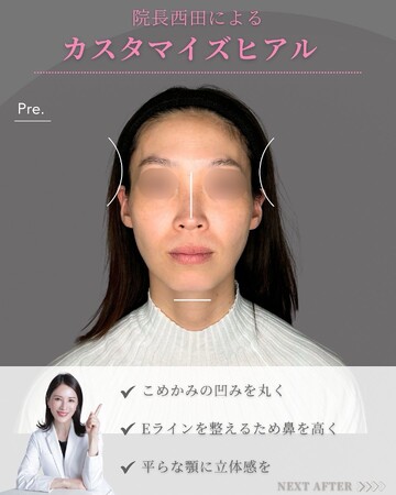 KNOT CLINIC AOYAMAの輪郭・顎・エラ・額・小顔整形の症例写真