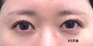 医療法人秀晄会 心斎橋コムロ美容外科クリニックの症例写真[アフター]