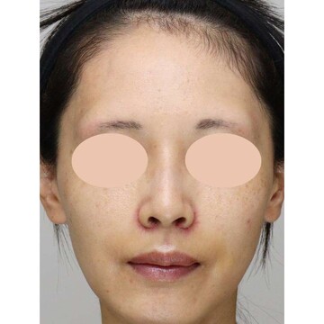 聖心美容クリニックの症例写真[アフター]