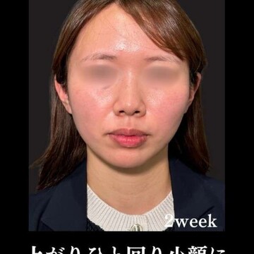 PRISM Beauty Clinicの症例写真[アフター]