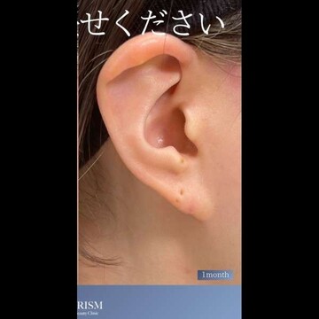PRISM Beauty Clinicの症例写真[アフター]