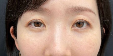 AI Beauty Clinicの症例写真[アフター]