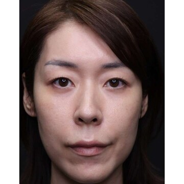 聖心美容クリニックの症例写真[アフター]