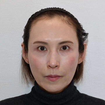 すなおクリニックの症例写真[アフター]