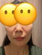 ペルラクリニック神宮前の症例写真[アフター]