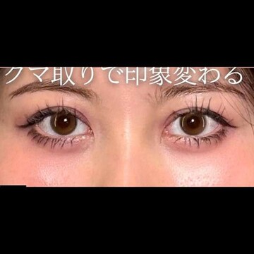 PRISM Beauty Clinicの症例写真[アフター]