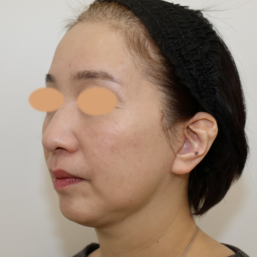 すなおクリニックの症例写真[アフター]