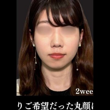 PRISM Beauty Clinicの症例写真[アフター]