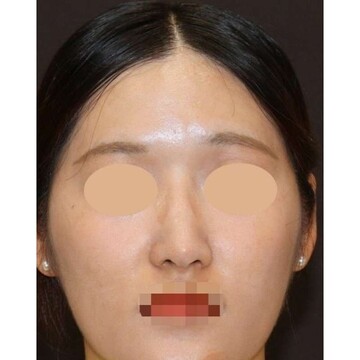 聖心美容クリニックの症例写真[アフター]