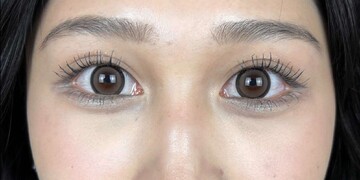 AI Beauty Clinicの症例写真[アフター]