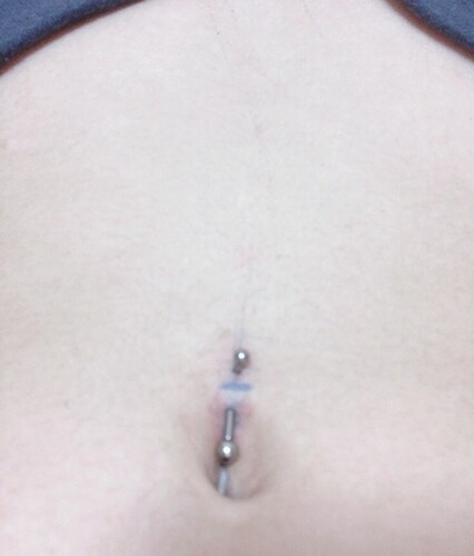 へそピアスの不安 ピアス穴あけ ボディピアス の治療への不安 痛み 失敗 副作用