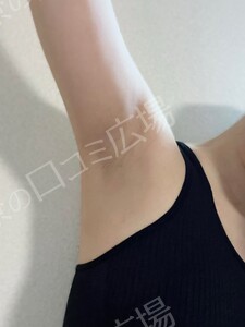 治療結果の症例写真