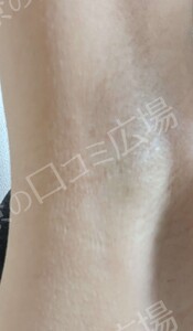 治療前の症例写真