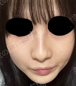 治療前の症例写真