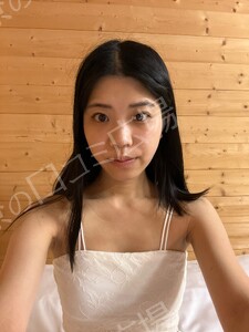 治療結果の症例写真