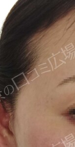 治療前の症例写真