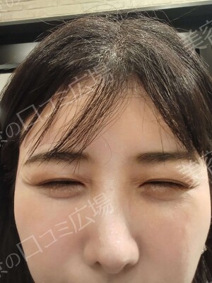 アネシス美容クリニックの症例写真[アフター]