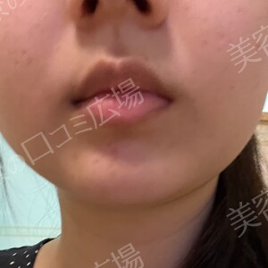 治療前の症例写真