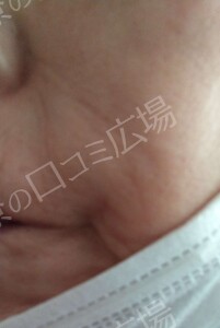 治療前の症例写真