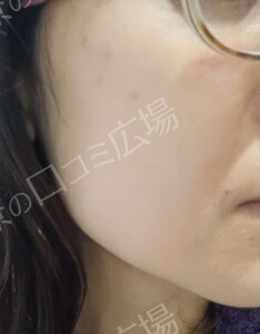 治療結果の症例写真