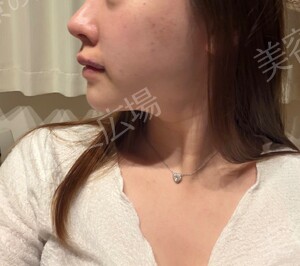 治療前の症例写真