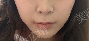 治療前の症例写真