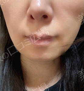 治療結果の症例写真