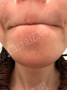 治療結果の症例写真