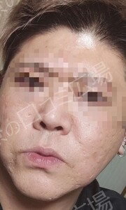 治療前の症例写真