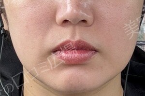治療前の症例写真