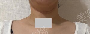 治療前の症例写真