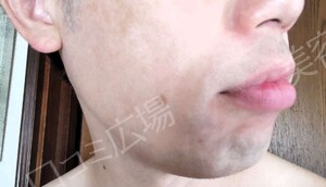 治療結果の症例写真