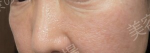 治療結果の症例写真