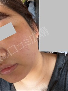 治療前の症例写真