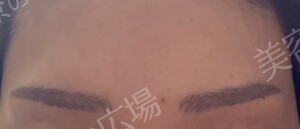 治療結果の症例写真