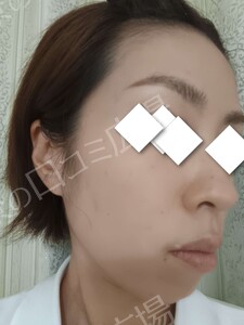 治療前の症例写真