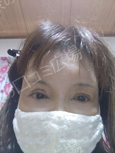 治療結果の症例写真