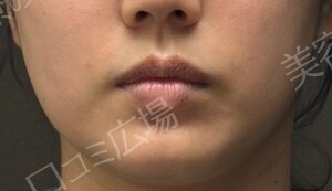 治療結果の症例写真