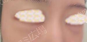 治療前の症例写真