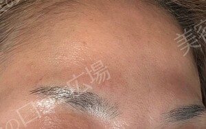 治療結果の症例写真