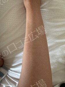 治療結果の症例写真