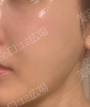THE CLINIC NAGOYA 【ザ・クリニック名古屋】の症例写真[アフター]