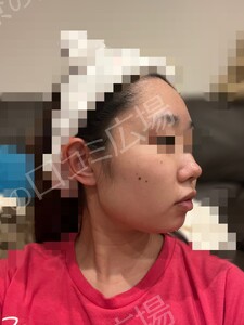 治療前の症例写真