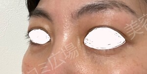 治療結果の症例写真