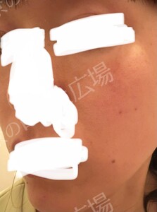治療結果の症例写真