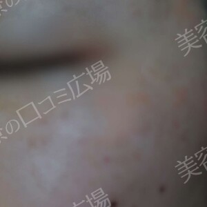 治療結果の症例写真