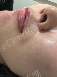 治療結果の症例写真